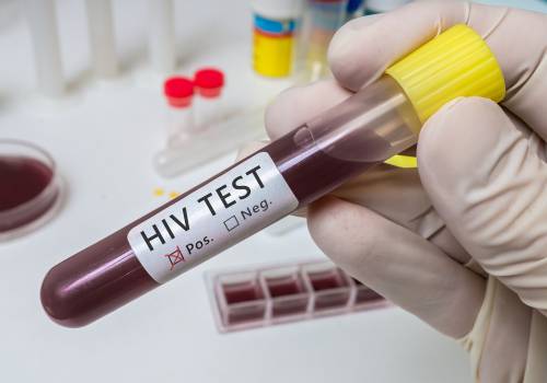 Komórki macierzyste z krwi pępowinowej wyleczyły chorą zakażoną wirusem HIV