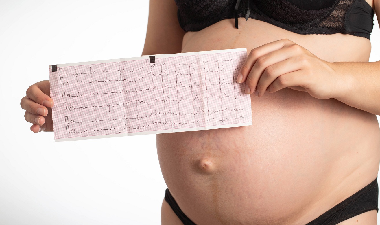 Problemy kardiologiczne w ciąży