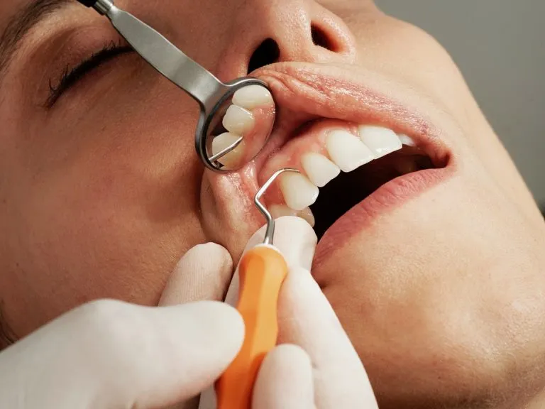 Ciąża, a wizyty u dentysty