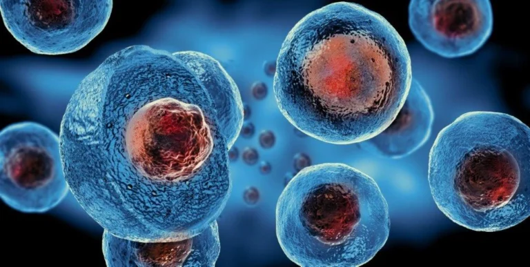 The use of autologous cord blood in a patient with MPD - a case report